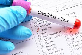 60-27-5 Causes of abnormal creatinine levels;symptoms;creatinine tests