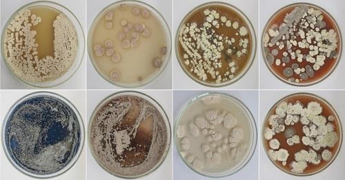 Streptomyces microflavus.jpg