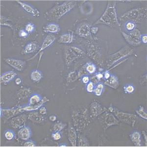 BCaP-37 Fresh Cells|人乳腺癌细胞(送STR基因图谱)