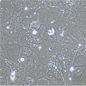 KYSE-150 Fresh Cells|人食管鳞癌细胞(送STR基因图谱)