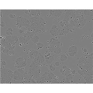KYSE-450 Fresh Cells|人食管癌细胞(送STR基因图谱)
