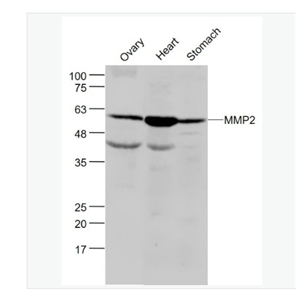 Anti-MMP2 antibody-基质金属蛋白酶2抗体