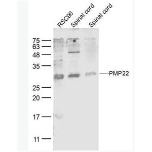 Anti-MMP1 antibody-外基质金属蛋白酶-1抗体