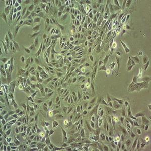 COL0205	人结直肠腺癌细胞