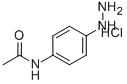 4-ACETAMIDOPHENYLHYDRAZINE HYDROCHLORIDE Struktur