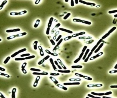 蜡样芽孢杆菌镜检图片图片