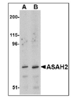 ASAH2酰基鞘氨醇脱酰酶2抗体