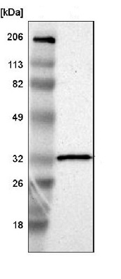 Western blot - Anti-HCCS antibody (ab224321)