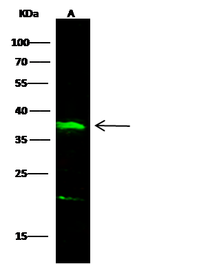 ANTI-IL-12 P70抗体