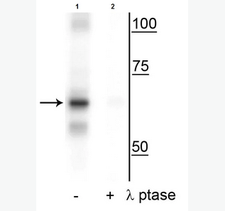 Western blot - Anti-NF-kB p65 (phospho S316) antibody