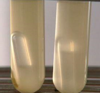 乳糖胆盐发酵管