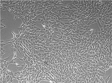 间充质干细胞培养基