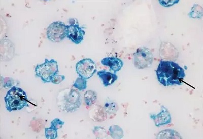 普鲁士蓝细胞学染色