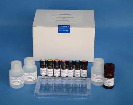DEAE-DEXTRAN细胞转染试剂盒的应用