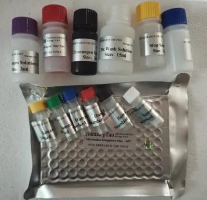 	人细胞周期素D1(CYCLIN-D1)ELISA试剂盒