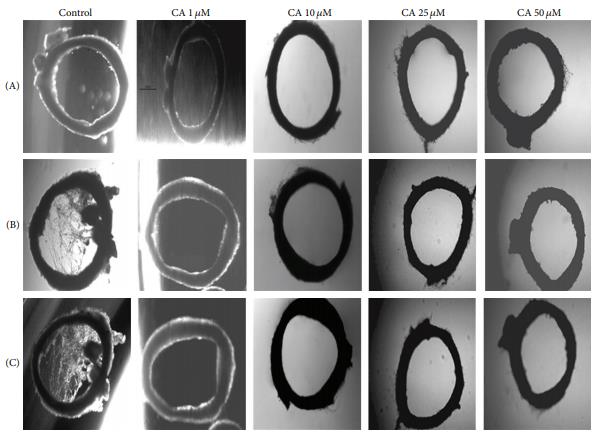 Effect of chebulagic acid on sprouting of rat aortic rings. Rat aortic ring explants were maintained in culture in the presence of 10% fetal bovine serum (FBS). Different concentrations of chebulagic acid (1 ??M, 10 ??M, 25 ??M, and 50 ??M) were supplemented to the medium and was monitored sprouting, under a microscope at different time intervals. The morphological changes were visualized and photographed under a microscope (×4) on the 1st (A), 3rd (B), and 5th (C) days. Each set was done in replicates, and the microphotographs from a representative experiment are given. 