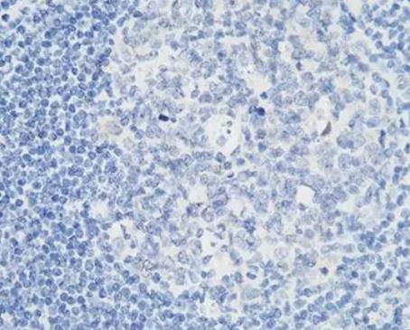 RECOMBINANT HUMAN P53 MUTANT细胞肿瘤抗原P53 突变型的应用