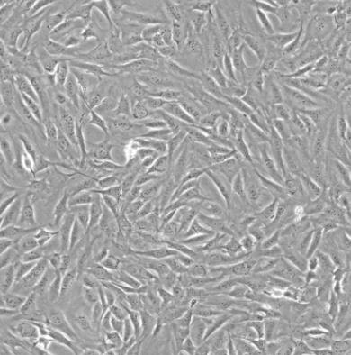小鼠胚胎瘤细胞.png