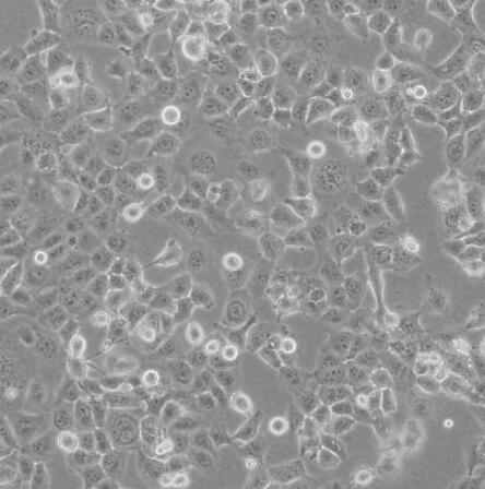NCI-H1299人非小细胞肺癌贴壁细胞系