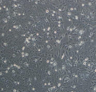 QG-56人肺扁平上皮癌贴壁细胞系的应用