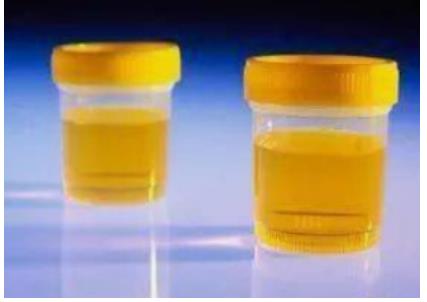 图1纳美芬的性状