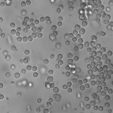 EL4小鼠淋巴瘤细胞.png EL4小鼠淋巴瘤细胞.png