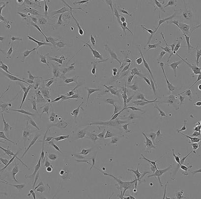 HUNS1人多发性骨髓瘤贴壁细胞系.png HUNS1人多发性骨髓瘤贴壁细胞系.png
