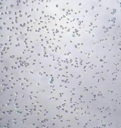 兔腹腔巨噬细胞.png 兔腹腔巨噬细胞.png