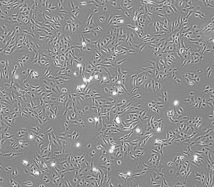 HSC-4 人口腔鳞癌细胞系.png HSC-4 人口腔鳞癌细胞系.png