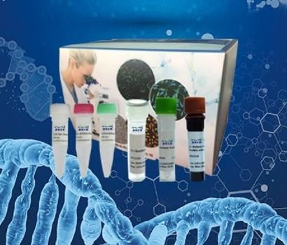 酯化梭状芽孢杆菌PCR试剂盒的应用