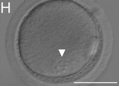 用ionomycin（离子霉素，钙离子载体）和DMAP（6-dimethylaminopurine，6-二甲基氨基嘌呤）完成胚胎激活后，出现了若干新的细胞核.jpg