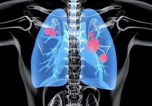 阿魏酸乙酯治疗肺损伤的潜能研究