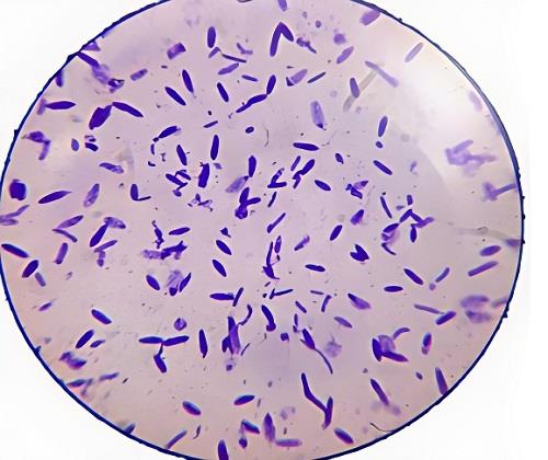 丁酸梭菌：肠道健康的守护者