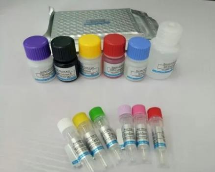 人细胞角蛋白21-1片段(CYFRA21-1)Elisa试剂盒的应用