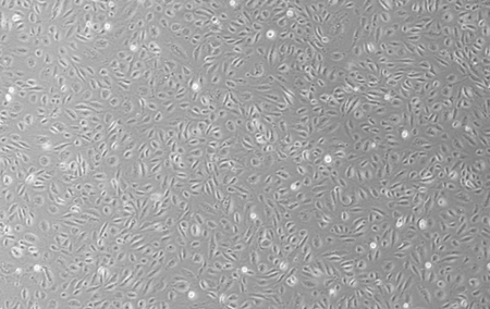 HUVEC(SCIENCELL) 人脐静脉内皮细胞