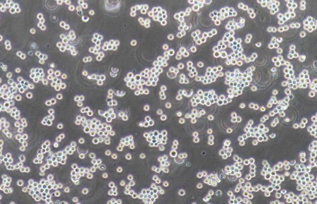 人慢性骨髓性白血病细胞系K562 人慢性骨髓性白血病细胞系K562