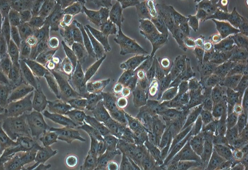 KMS-11 人多发性骨髓瘤细胞系