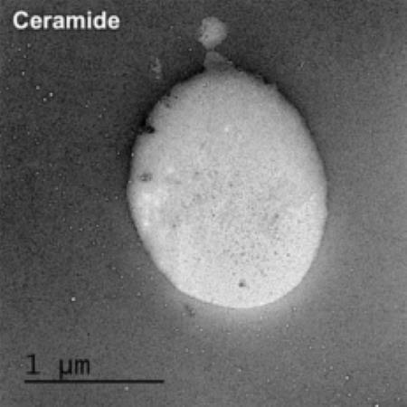 神经酰胺NP的纳米颗粒TEM图.png 神经酰胺NP的纳米颗粒TEM图.png