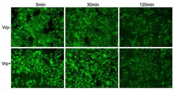 人肝癌细胞系HepG2摄取罗丹明 123染料在 5min、30min和120min后的图像 人肝癌细胞系HepG2摄取罗丹明 123染料在 5min、30min和120min后的图像