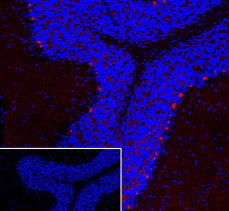 PSD95抗体的相关研究