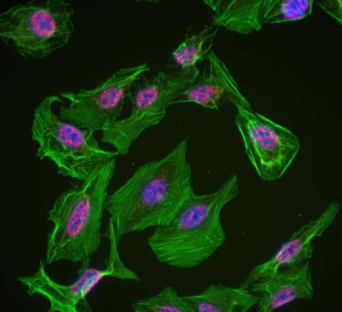 ZEB2抗体的应用实例