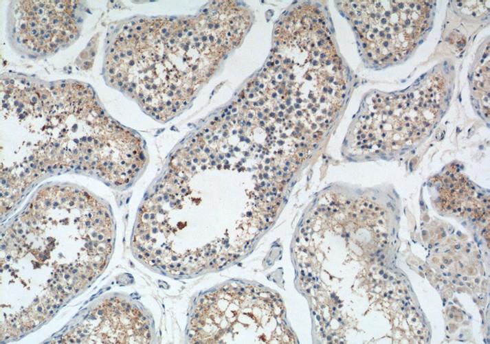使用PIWIL2抗体对石蜡包埋人睾丸组织切片进行免疫组织化学分析 使用PIWIL2抗体对石蜡包埋人睾丸组织切片进行免疫组织化学分析
