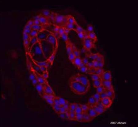 图1 E 钙粘蛋白抗体图.png 图1 E 钙粘蛋白抗体图.png