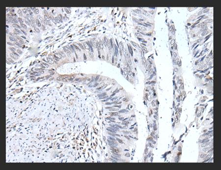 图1 UBE2T抗体显微图.png 图1 UBE2T抗体显微图.png