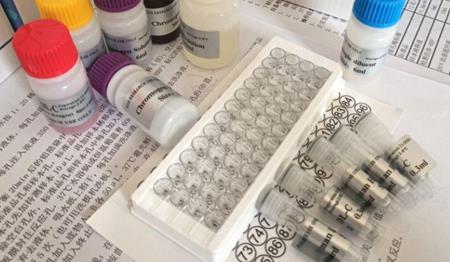 人抗腮腺管抗体(anti-parotidductAb)Elisa试剂盒的临床意义及使用介绍