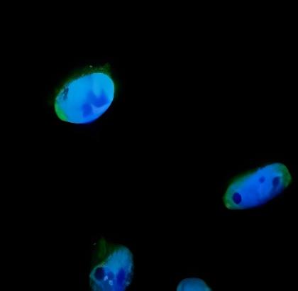 HIF1A抗体的用途及病理意义