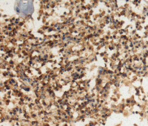 DHX8抗体的应用研究