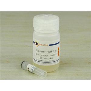 Phospho-Aurora抗体(兔单抗)