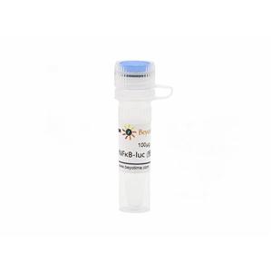 pNFκB-luc (报告基因质粒)