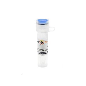 pCMV-N-DsRed (红色荧光蛋白)